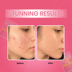 Turmeric kojic acid pads