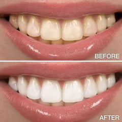 Hismile V34 Colour Corrector Serum 30ml