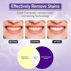 Hismile V34 Colour Corrector Serum 30ml