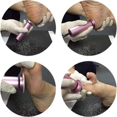 Electric Foot File Callus Remover for Feet